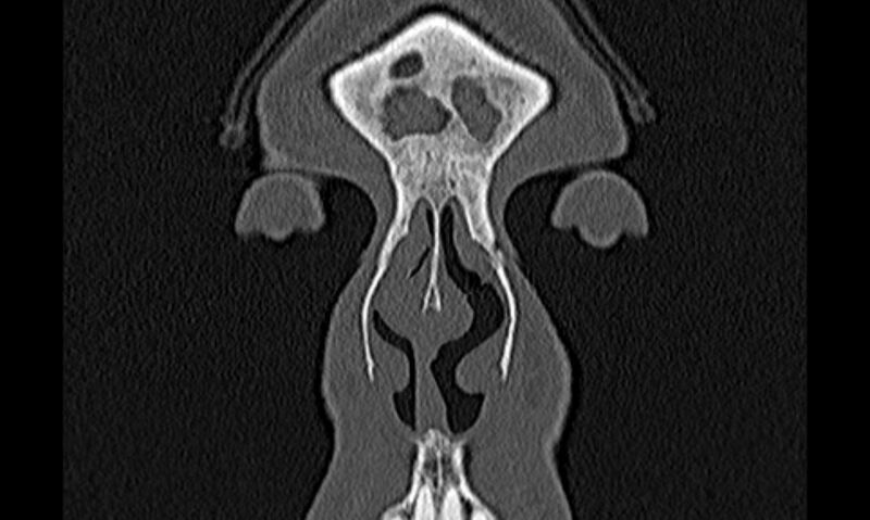 File:Chronic rhinosinusitis (Radiopaedia 65079-74075 Coronal bone window 2).jpg