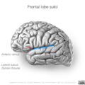 Neuroanatomy- lateral cortex (diagrams) (Radiopaedia 46670-51202 C 9).png