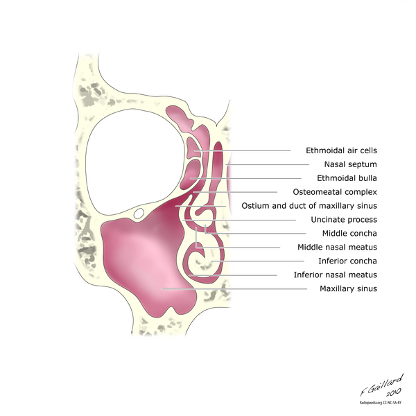File:Normal ostiomeatal complex (illustration) (Radiopaedia 9446-10126 A 1).png