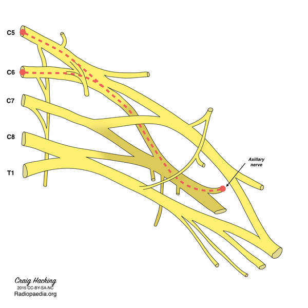 File:Brachial plexus (diagram) (Radiopaedia 37612-39492 Axillary nerve 1).png