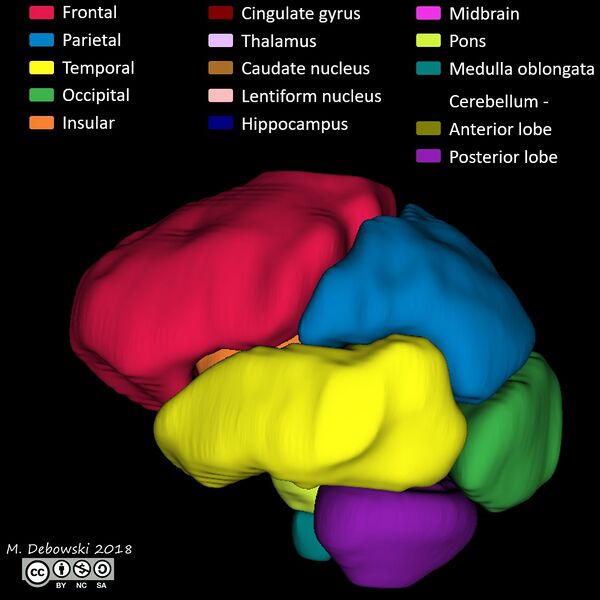 File:Brain lobes - annotated MRI (Radiopaedia 61691-69700 3D reconstruction 42).JPG