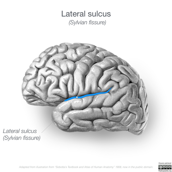 File:Neuroanatomy- lateral cortex (diagrams) (Radiopaedia 46670-51202 Lateral sulcus 6).png
