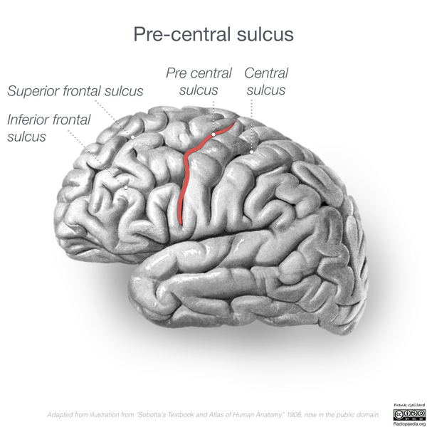 File:Neuroanatomy- lateral cortex (diagrams) (Radiopaedia 46670-51202 Precentral sulcus 2).png