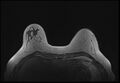 Normal breast MRI - dense breasts (Radiopaedia 80454-93850 Axial T1 52).jpg