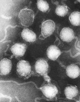 TEM image revealed the presence of La Crosse (LAC) encephalitis virus ribonucleoprotein particles
