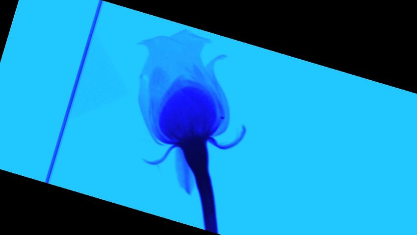 Blue rose (Radiopaedia 23430-23511 A 136).jpg