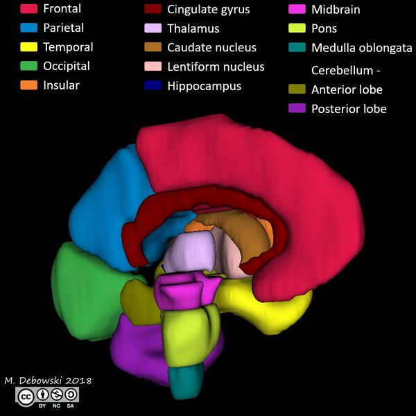 File:Brain lobes - annotated MRI (Radiopaedia 61691-69700 3D reconstruction 4).JPG