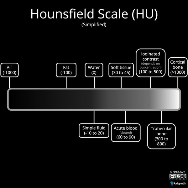 File:Hounsfield scale (diagram) (Radiopaedia 77397).jpeg