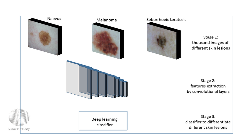 File:Overview of training of different types of skin lesions with the help of deep learning. (DermNet NZ Overview-of-training-of-different-types-of-skin-lesions-with-the-help-of-deep-learning).png