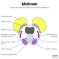 Brainstem cross-sectional anatomy (diagrams) (Radiopaedia 81958-95923 Entire brainstem 2).jpeg