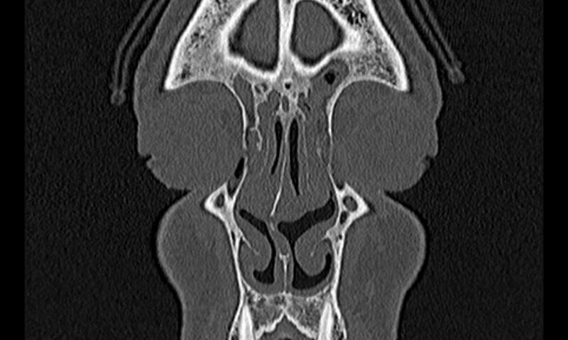 File:Chronic rhinosinusitis (Radiopaedia 65079-74075 Coronal bone window 12).jpg