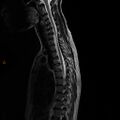 Normal spine MRI (Radiopaedia 77323-89408 E 7).jpg
