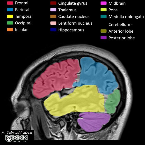 File:Brain lobes - annotated MRI (Radiopaedia 61691-69700 Sagittal 65).JPG