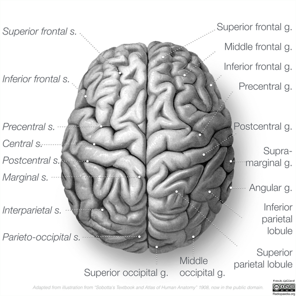 File:Neuroanatomy- superior cortex (diagrams) (Radiopaedia 59317-66667 B 1).png