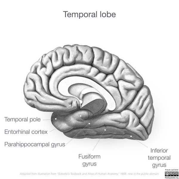 File:Neuroanatomy- medial cortex (diagrams) (Radiopaedia 47208-52697 Temporal lobe gyri 5).png