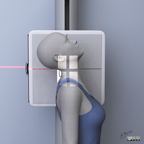 File:Cervical radiography - illustrations (Radiopaedia 80305-93667 None 5).jpg