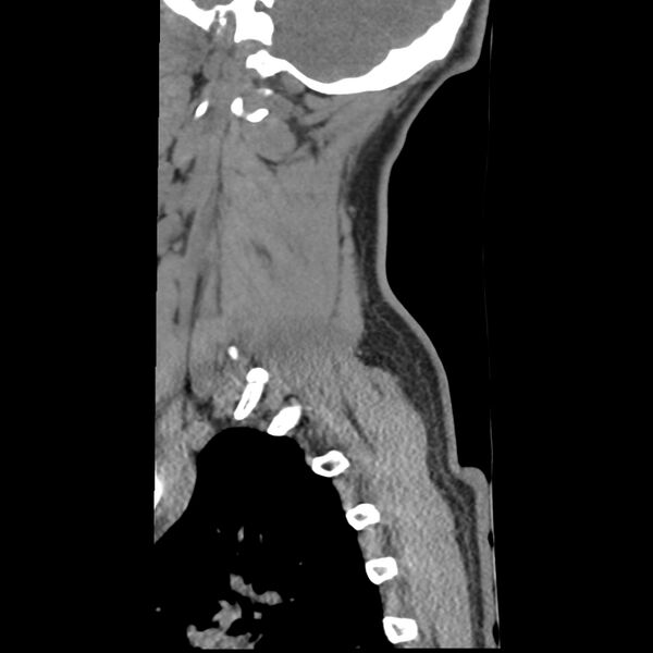 File:Normal trauma spine imaging (Radiopaedia 31753-32686 A 3).jpg
