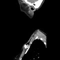 Normal CT of the neck (Radiopaedia 14575-14500 Sagittal C+ 47).jpg