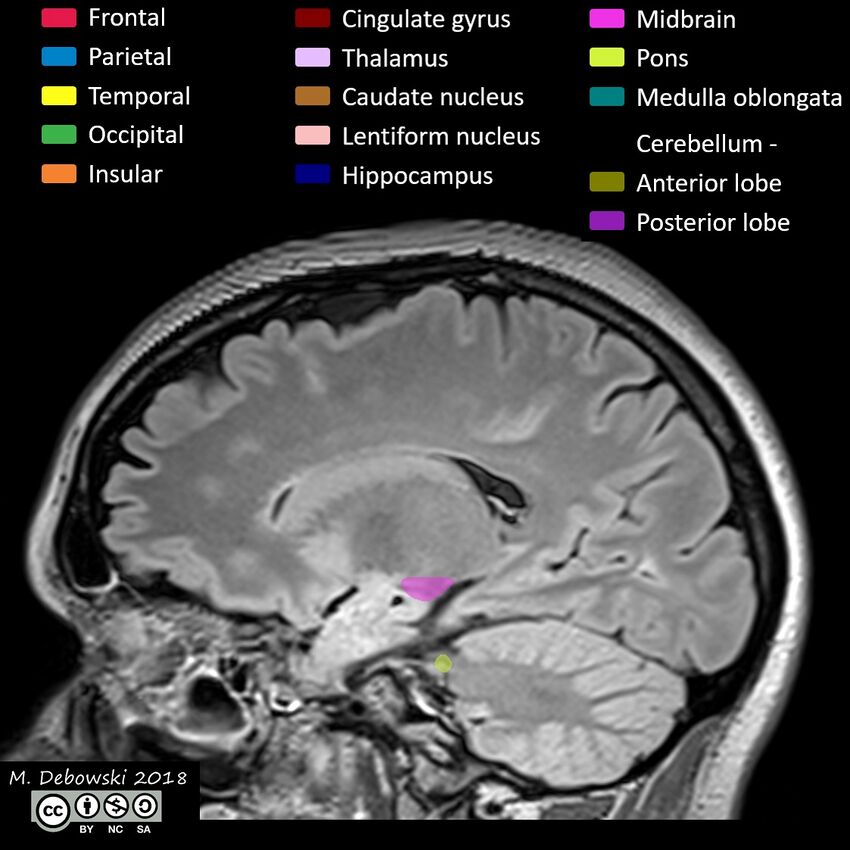 Brain lobes - annotated MRI (Radiopaedia 61691-69700 Sagittal 29).JPG