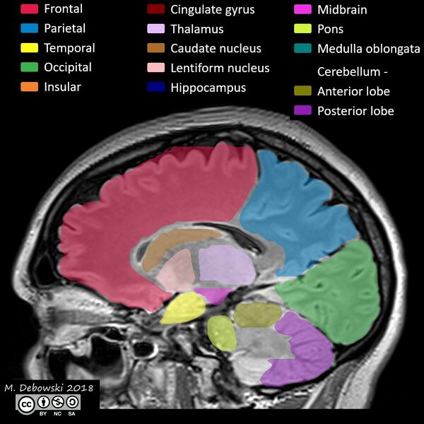 File:Brain lobes - annotated MRI (Radiopaedia 61691-69700 Sagittal 48).JPG