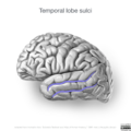 Neuroanatomy- lateral cortex (diagrams) (Radiopaedia 46670-51201 G 3).png