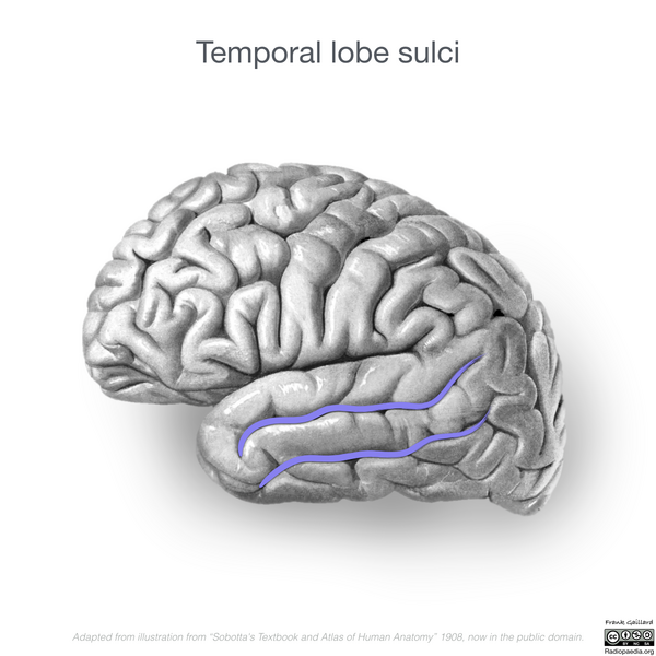 File:Neuroanatomy- lateral cortex (diagrams) (Radiopaedia 46670-51201 G 3).png