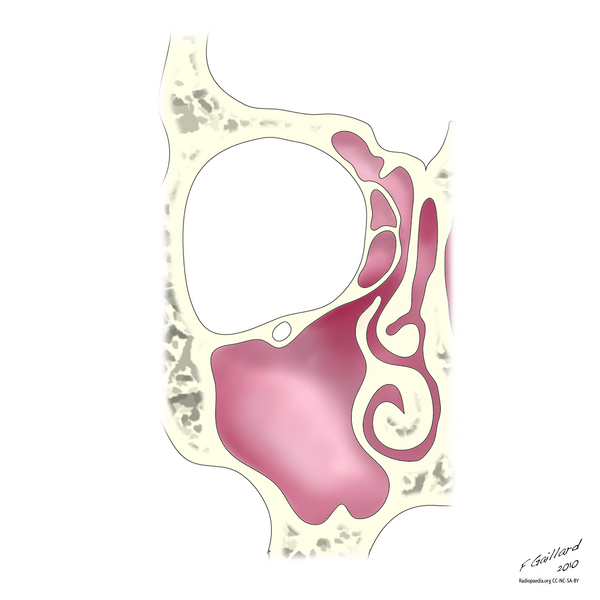 File:Normal ostiomeatal complex (illustration) (Radiopaedia 9446-10126 B 1).png