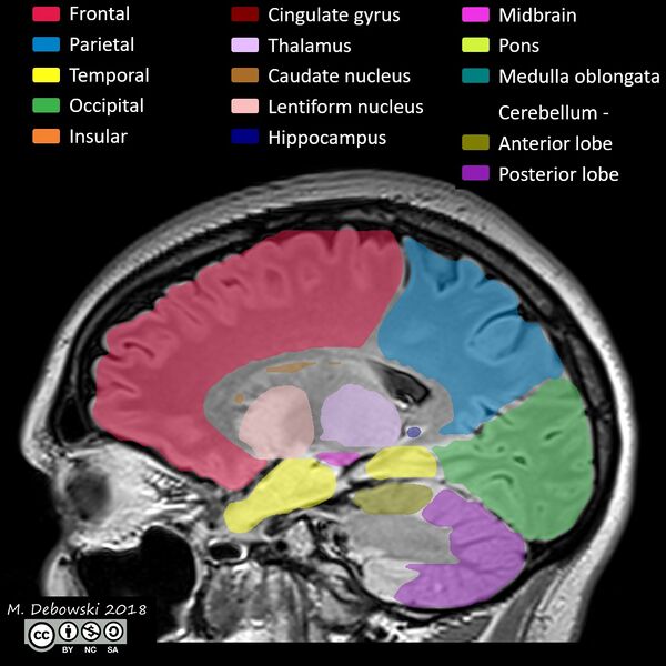File:Brain lobes - annotated MRI (Radiopaedia 61691-69700 Sagittal 50).JPG