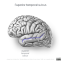 Neuroanatomy- lateral cortex (diagrams) (Radiopaedia 46670-51202 K 1).png