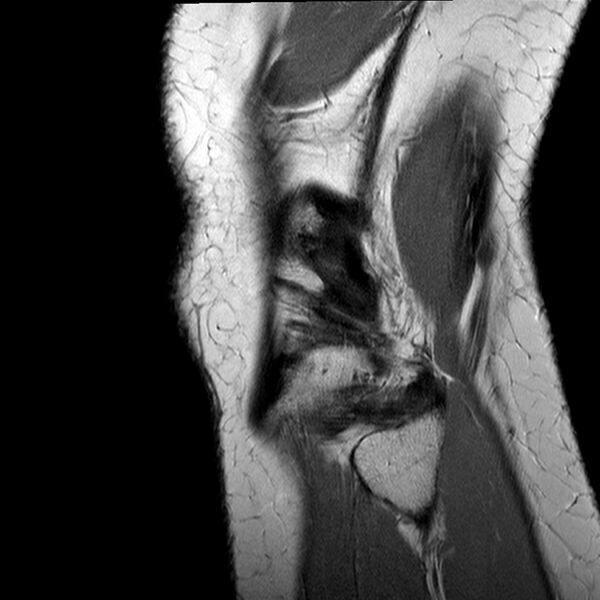 File:Anatomy Quiz (MRI knee) (Radiopaedia 43478-46865 A 24).jpeg