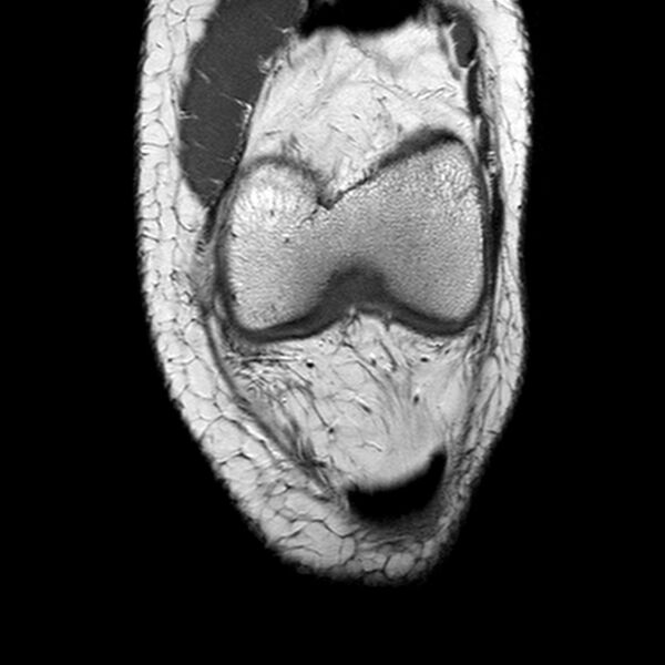 File:Anatomy Quiz (MRI knee) (Radiopaedia 43478-46874 A 6).jpeg