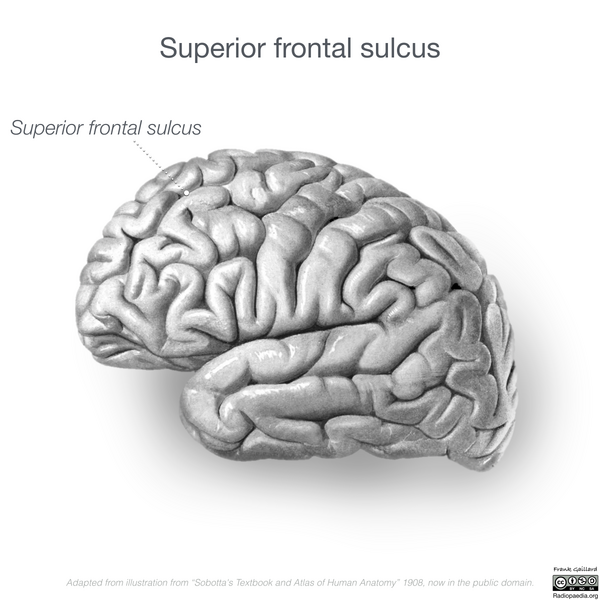 File:Neuroanatomy- lateral cortex (diagrams) (Radiopaedia 46670-51202 A 3).png