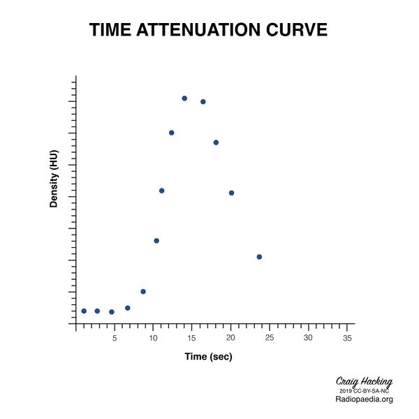 File:Brain perfusion - time attenuation curves (Radiopaedia 70313-80395 Curve generation 14).jpeg
