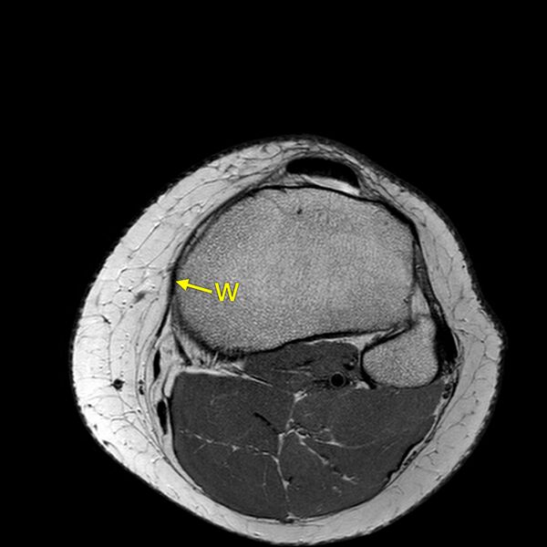 File:Anatomy Quiz (MRI knee) (Radiopaedia 43478-46866 A 24).jpeg