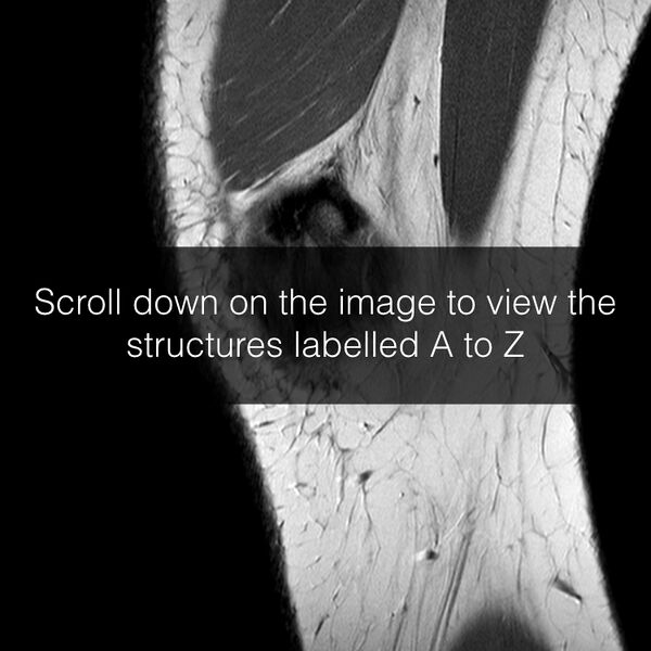 File:Anatomy Quiz (MRI knee) (Radiopaedia 43478-46865 A 1).jpeg