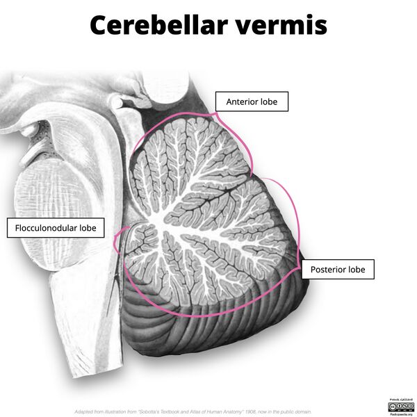 File:Cerebellar vermis (illustration) (Radiopaedia 90395-107720 C 1).jpg