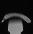 Banana (Radiopaedia 52587-58499 Sagittal PD 9).jpg
