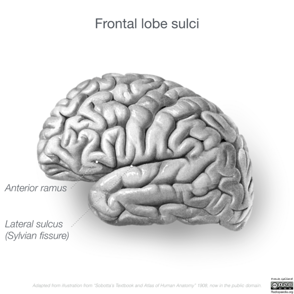 File:Neuroanatomy- lateral cortex (diagrams) (Radiopaedia 46670-51202 C 10).png