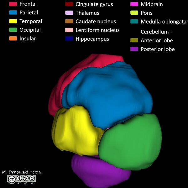 File:Brain lobes - annotated MRI (Radiopaedia 61691-69700 3D reconstruction 55).JPG