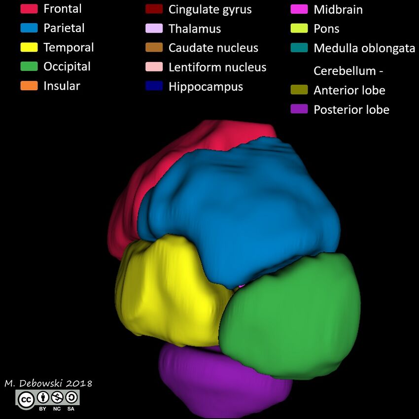 Brain lobes - annotated MRI (Radiopaedia 61691-69700 3D reconstruction 55).JPG