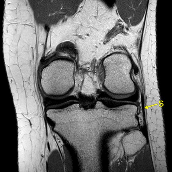 File:Anatomy Quiz (MRI knee) (Radiopaedia 43478-46874 A 21).jpeg