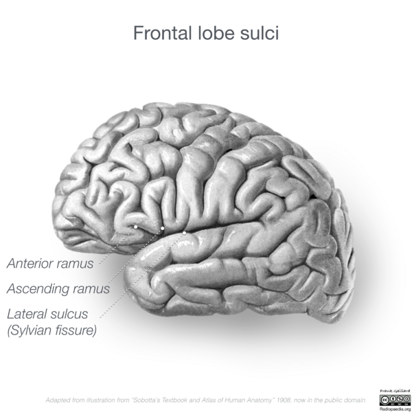 File:Neuroanatomy- lateral cortex (diagrams) (Radiopaedia 46670-51202 C 8).png