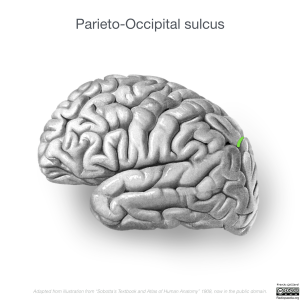 File:Neuroanatomy- lateral cortex (diagrams) (Radiopaedia 46670-51202 I 3).png