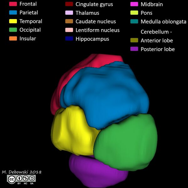 File:Brain lobes - annotated MRI (Radiopaedia 61691-69700 3D reconstruction 56).JPG