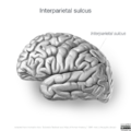 Neuroanatomy- lateral cortex (diagrams) (Radiopaedia 46670-51202 Interparietal sulcus 3).png