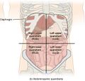 Abdominal surface anatomy (creative commons illustration) (Radiopaedia 59081-66374 B 1).jpg