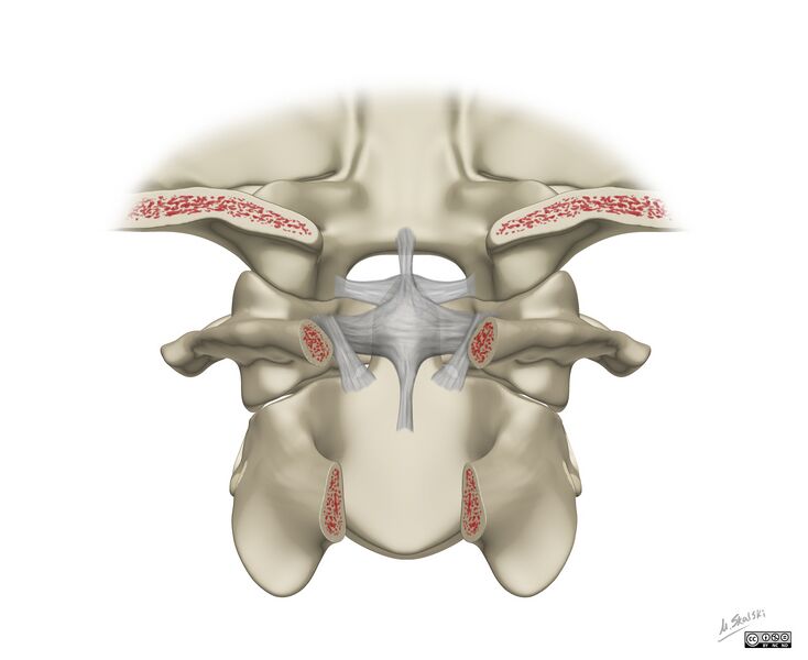File:Alar and cruciform ligament anatomy (Radiopaedia 45136-49117 B 1).jpg