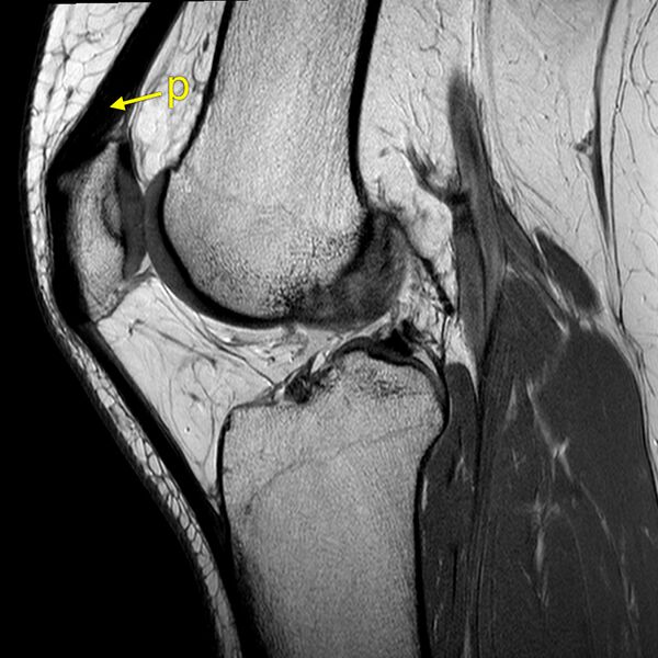 File:Anatomy Quiz (MRI knee) (Radiopaedia 43478-46865 A 15).jpeg