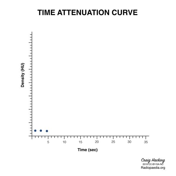 File:Brain perfusion - time attenuation curves (Radiopaedia 70313-80395 Curve generation 4).jpeg