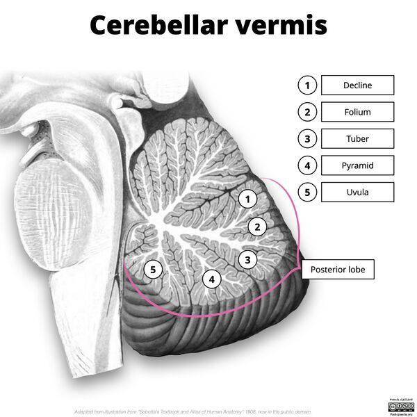 File:Cerebellar vermis (illustration) (Radiopaedia 90395-107720 E 1).jpg